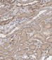 TECPR1 Antibody (C-term)